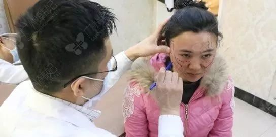 廣州韓妃美版超聲提拉和埋線提升提升日記一則，給你好看~