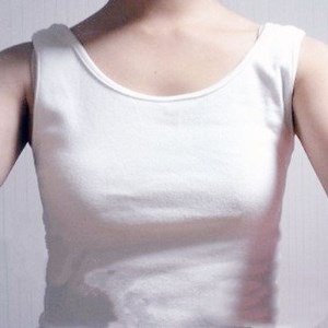 廣元美華楊林醫(yī)生做的自體脂肪隆胸，兩個(gè)月的果圖片分享~