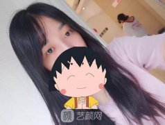 成都嬌點姜宇祿雙眼皮修復(fù)案例，重獲新生！