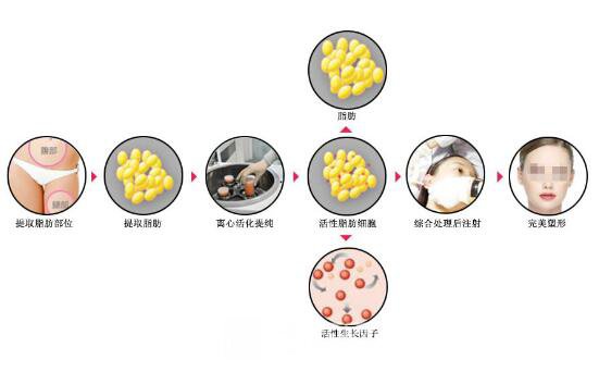 隆鼻+面部脂肪移植后變靚女告別單身