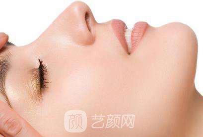 隆鼻手術你要了解的4個關鍵。