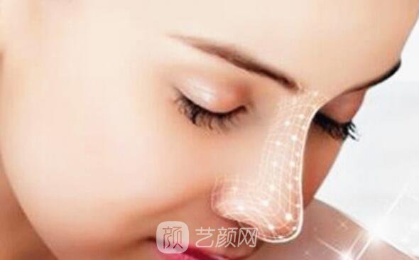 全鼻整形手術(shù)沒問題嗎?