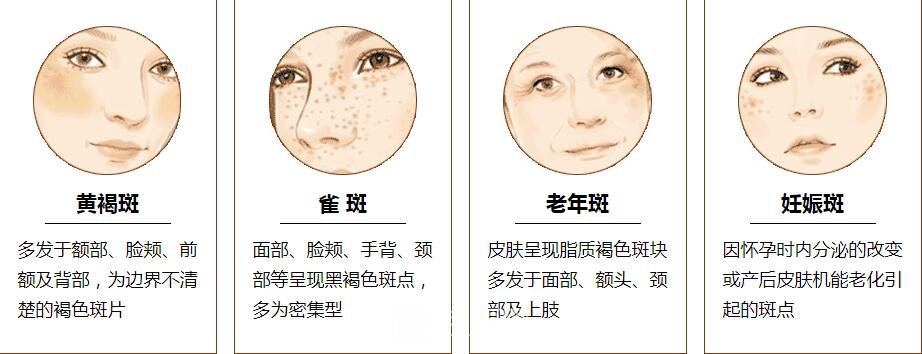 祛斑后不用化妝，我也可以一樣美麗。