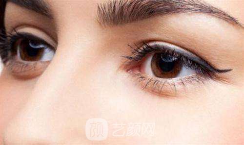 雙眼皮術(shù)后，必須經(jīng)歷的五個(gè)階段?