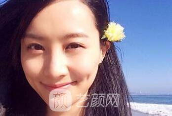 上海百達麗豐蘋果肌多少錢呢？