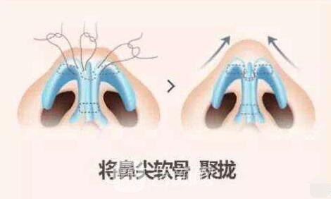 鼻子變高了，氣質變贊了，魅力無限被放大