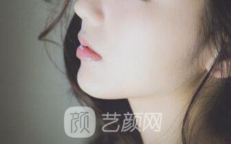 玻尿酸隆鼻+下巴之后，仿如新生，走上人生尖峰