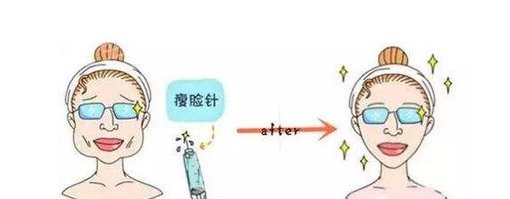 打注射瘦臉后臉真變小了，看來注射瘦臉真如傳聞所言