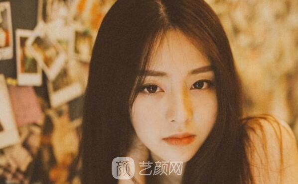韓式三點(diǎn)翹睫雙眼皮恢復(fù)過程心里美美噠