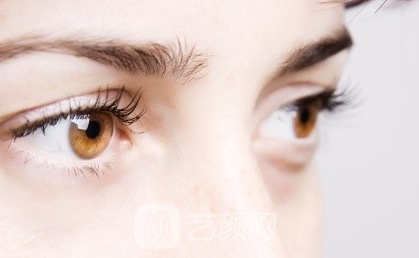 如何讓眼睛更美麗的雙眼皮手術(shù)？