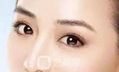 埋線雙眼皮的果不是******的？