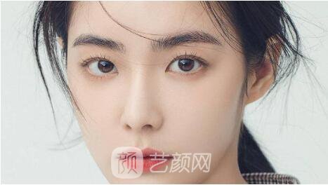 雙眼皮整形沒問題嗎？