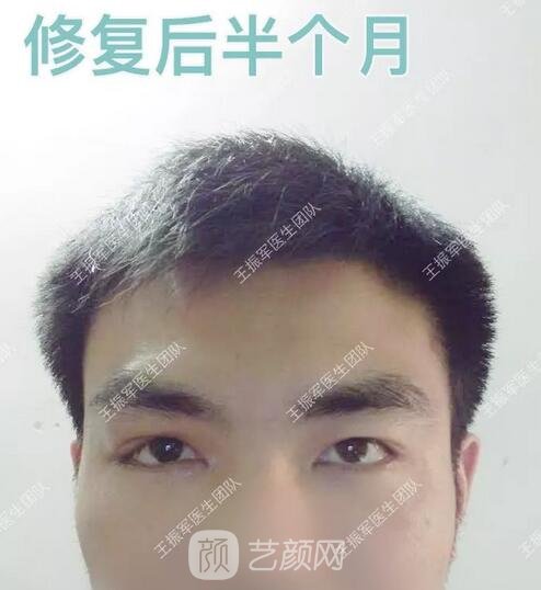 術(shù)后半個月果