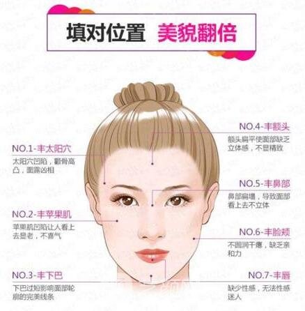 自體脂肪面部填充對(duì)位置，美貌翻一倍