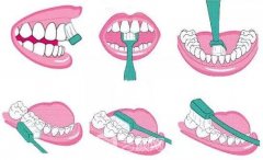 開講啦！種植牙護理大課堂鼓樓專場，上門就送598元大禮包！