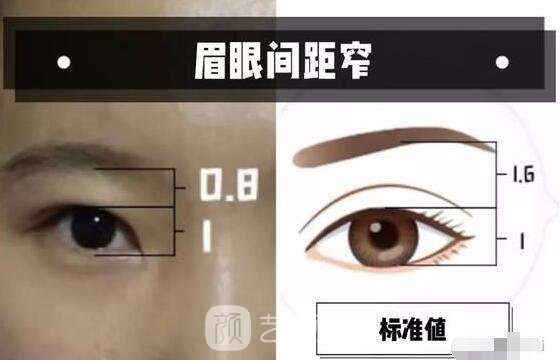 眉眼間間距