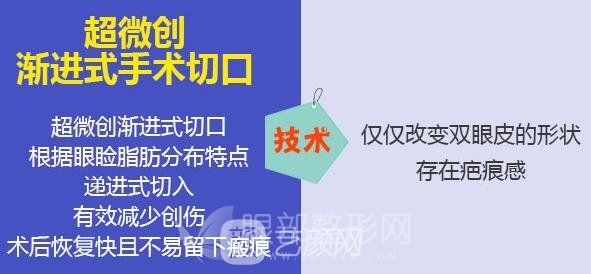 微創(chuàng)雙眼皮特點是什么