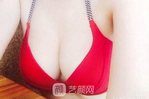 術(shù)后可能會產(chǎn)生乳房形變的情況，