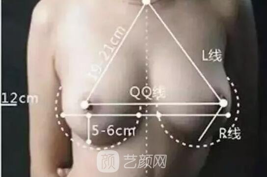假體隆胸手感會很差嗎?