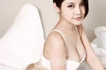 假體隆胸失敗修復(fù)時間：到底術(shù)后多久才能做修復(fù)？