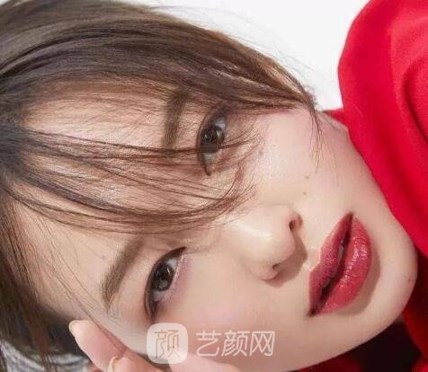 割雙眼皮微創(chuàng)好還是全切好？戳進來康康哪種適合你！