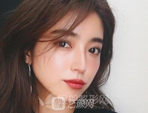 雙眼皮埋線法好不好 你的眼型該如何選擇術式