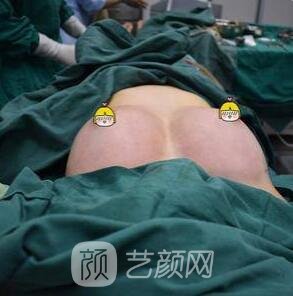 豐胸手術(shù)修復(fù)醫(yī)院該如何挑選呢?