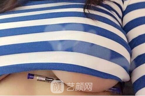 假體隆胸術(shù)后一定要做好護(hù)理工作哦!