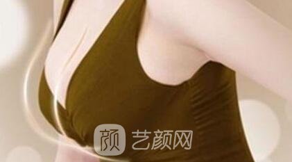 自體脂肪豐胸