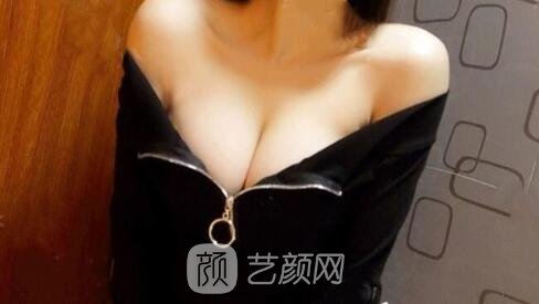 隆胸手術(shù)的后遺癥有哪些？感覺(jué)很可怕？