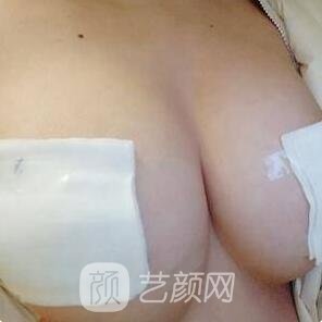 胸大比較好還是胸小比較好？