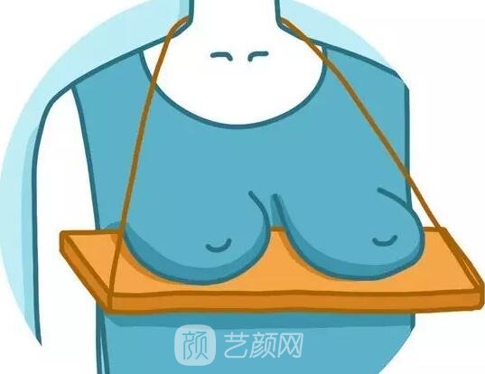 乳房下垂了應該怎么辦？挽救方法公開！