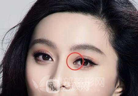 開(kāi)眼角果好不好
