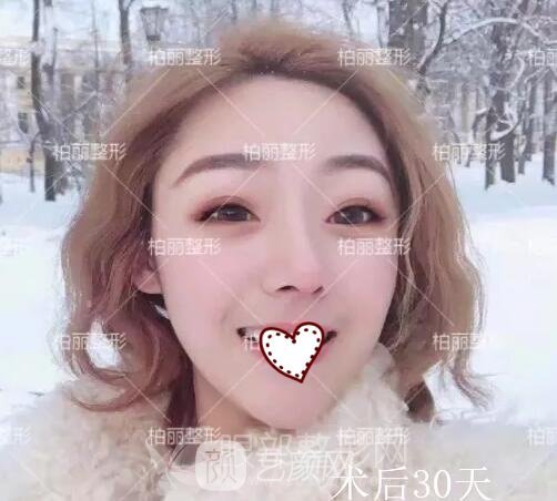 開(kāi)眼角果好不好 多久恢復(fù)？
