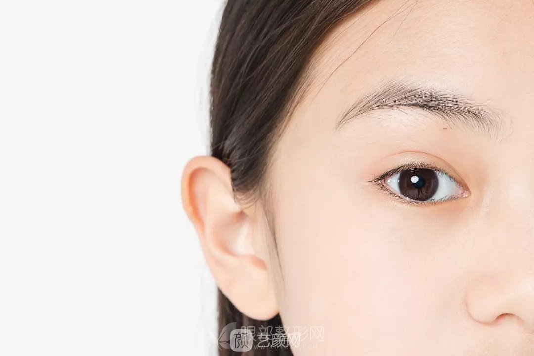 高分子雙眼皮輕松讓你變成女神，成為人群中較靚的那一個(gè)！