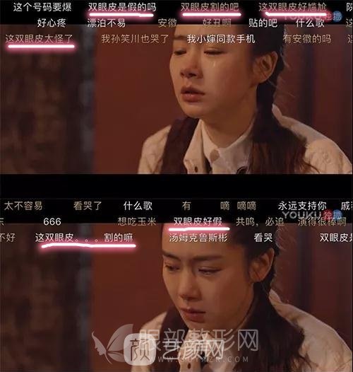 做雙眼皮哪種方式好